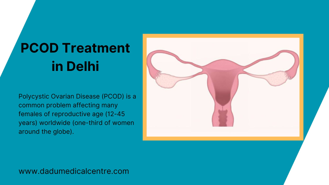 Pcod Treatment In Delhi